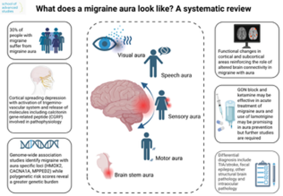 What does a migraine aura look like?—A systematic review | The Journal of Headache and Pain