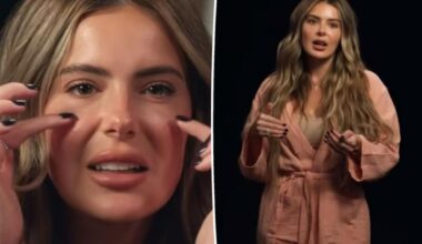 Brielle Biermann admits regrets over getting filler at young age