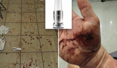 Exploding Nutribullet left NYC man with severed artery: Lawsuit