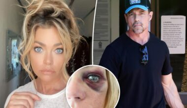 Aaron Phypers' pal claims Denise Richards' black eye was result of a drunken fall, not abuse
