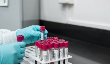 Simple blood test detects unique glycan linked to schizophrenia diagnosis