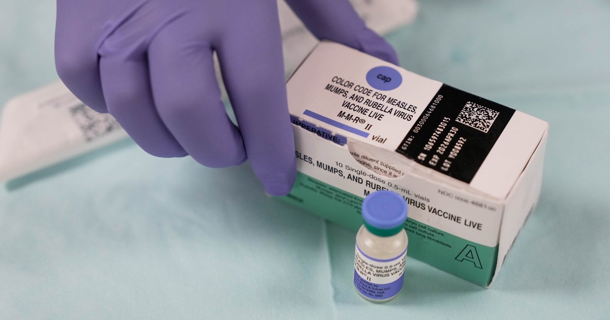 Why It Matters If The U.S. Loses The Measles Elimination Status