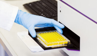 Beta-carotene keeps enzymes active under heavy load