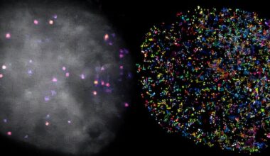 Microscopy reveals how Hippo pathway proteins control gene activity in cancer