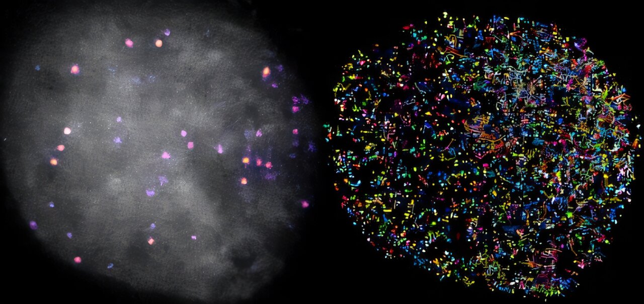 Microscopy reveals how Hippo pathway proteins control gene activity in cancer