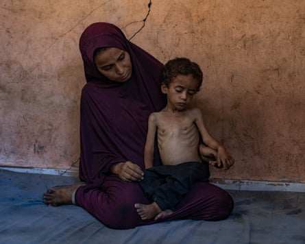 A malnourished Palestinian child sits on the floor with his mother