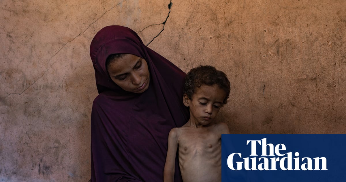 How will the UK’s recognition of Palestine help those starving in Gaza? - podcast | Gaza