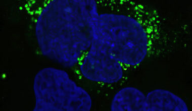 New AI tool illuminates “dark side” of the human genome