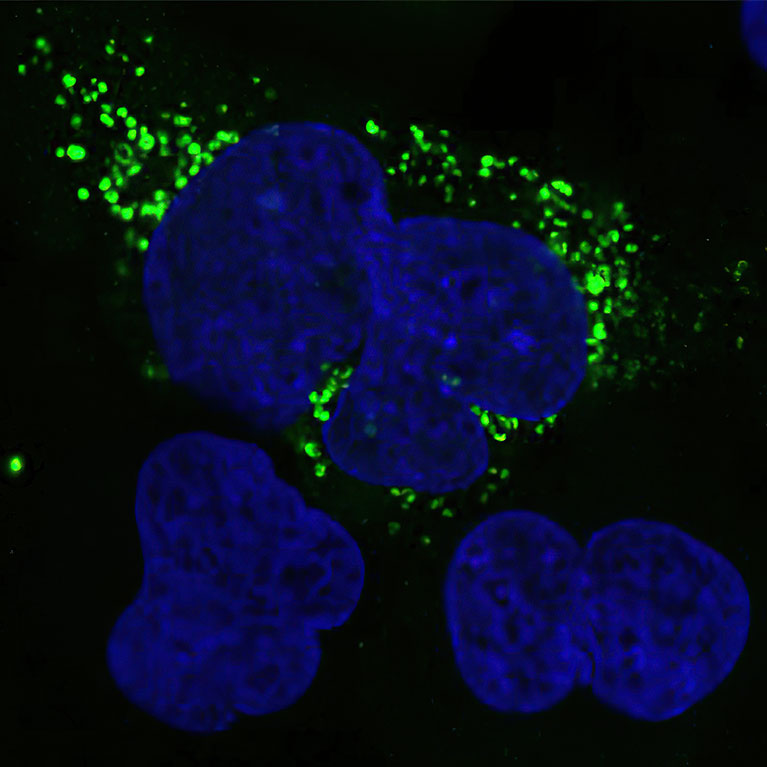 New AI tool illuminates “dark side” of the human genome