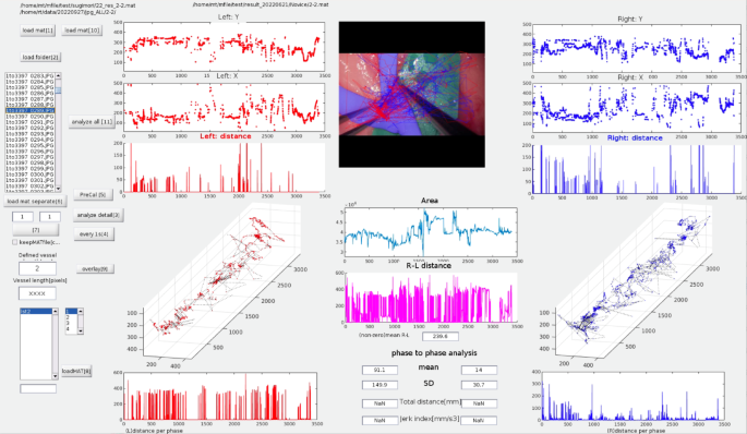 Artificial intelligence-integrated video analysis of vessel area changes and instrument motion for microsurgical skill assessment