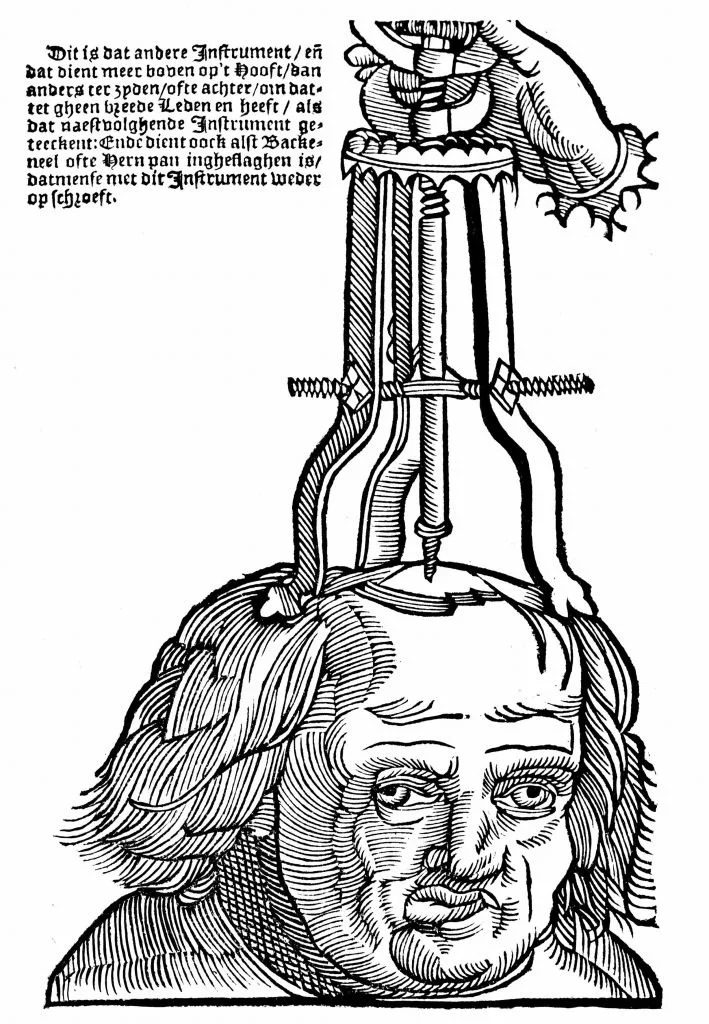 An old illustration of a medical instrument with a human face, possibly depicting an ancient procedure or invention