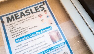 Measles Outbreak Hits Another State