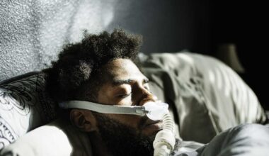 Doctor on research showing that sleep apnea diagnoses could double by the end of the 21st century