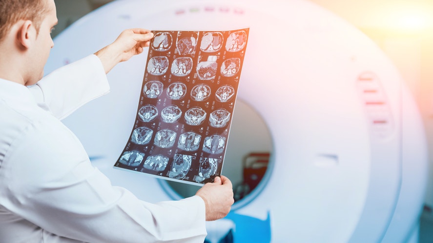 Revvity Slashes Outlook As China Policy Deals Diagnostics Blow