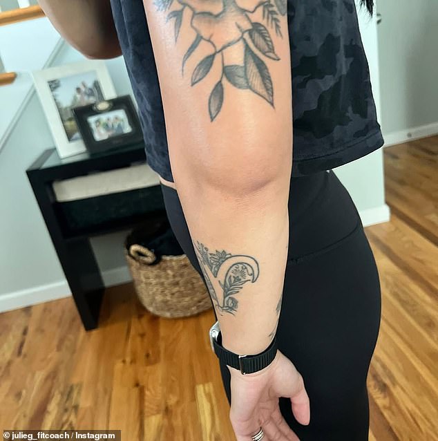 'My arm was sore in a way that I had never felt before and started to massively swell,' she says. (Julie's swollen arm, caused by rhabdomyolysis, is shown here)