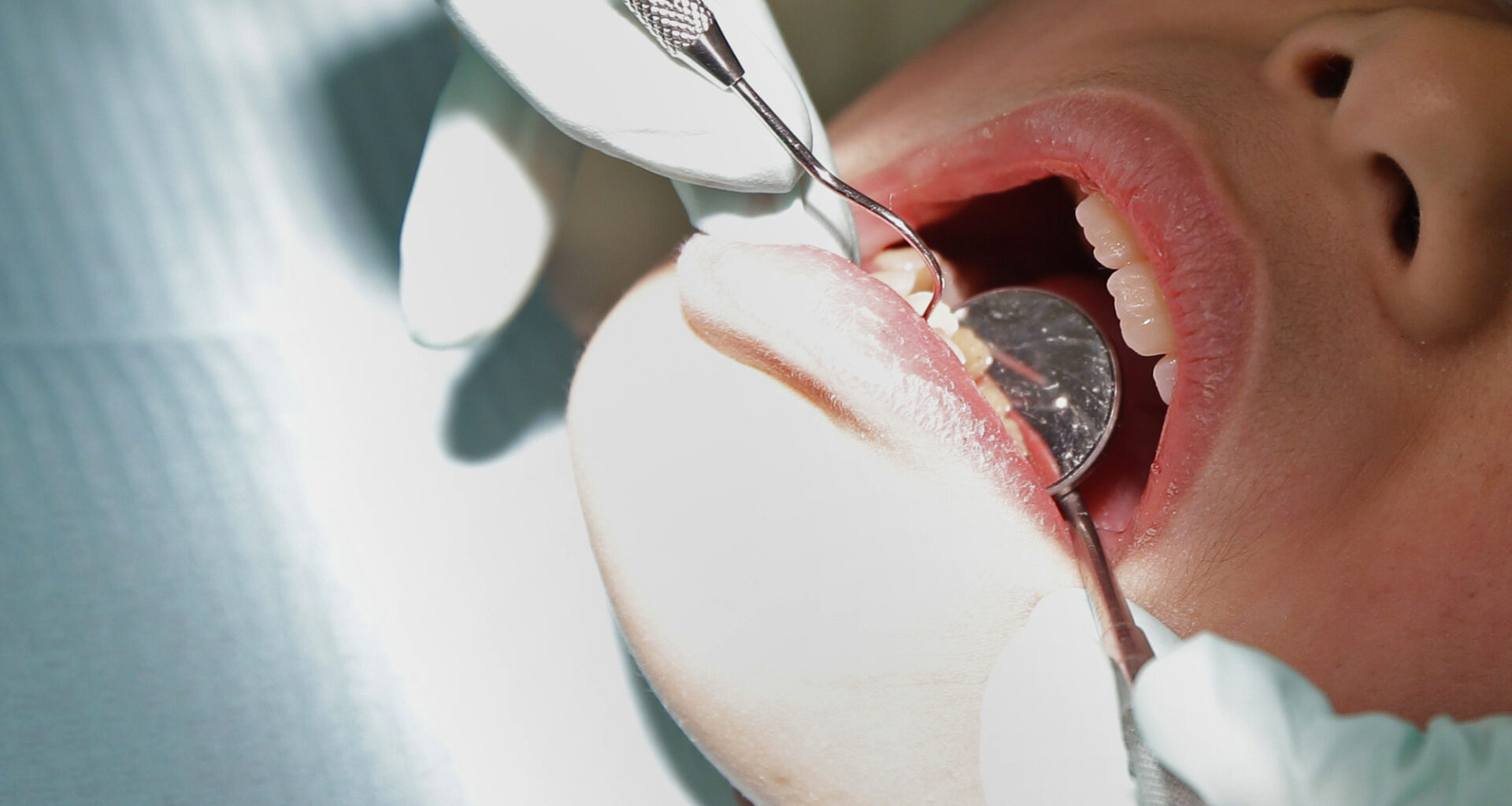 Dentists across Wisconsin worry after insurance company buys large dental practice