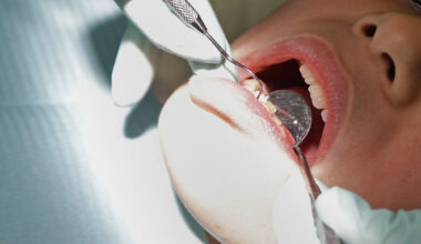 Dentists across Wisconsin worry after insurance company buys large dental practice