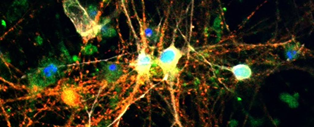 Surprise Discovery About Sugar in The Brain Could Help Fight Alzheimer's : ScienceAlert