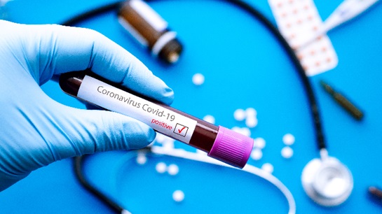 CALI supports ban on genetic testing in life insurance underwriting