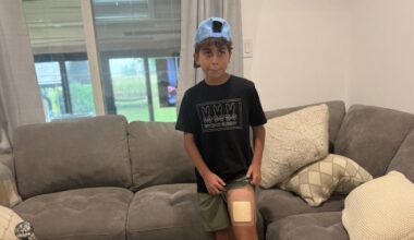 Ontario boy recalls coyote attack that left him with 4 puncture wounds