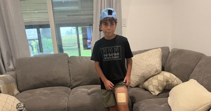 Ontario boy recalls coyote attack that left him with 4 puncture wounds
