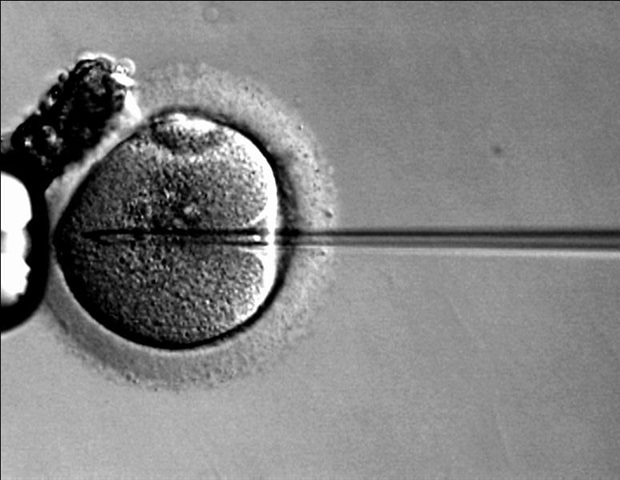 Breakthrough gene therapy reverses genetic deafness across age groups