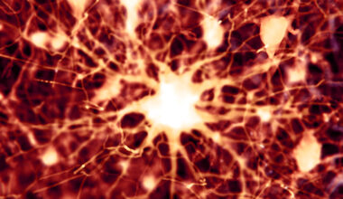 Scientists Find 2 Existing Drugs Can Reverse Alzheimer's Brain Damage in Mice : ScienceAlert