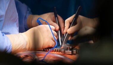 Surgeons Resuscitate 'Dead' Heart in Life-Saving Organ Transplant to Baby : ScienceAlert