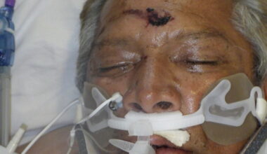 LA Hospital Seeks ID of Man Struck by Vehicle