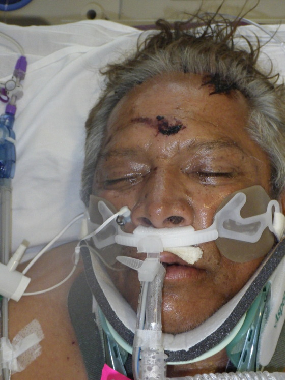 LA Hospital Seeks ID of Man Struck by Vehicle