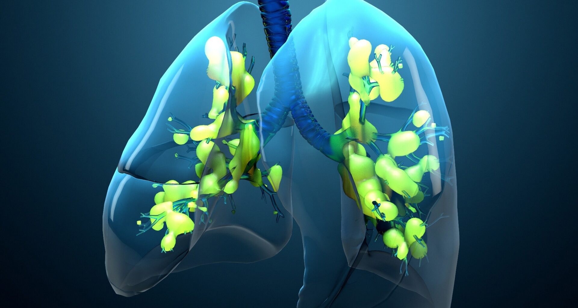 Review: Artificial intelligence and machine learning in acute respiratory distress syndrome management: recent advances. Image Credit: Design_Cells / Shutterstock