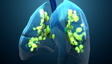 Review: Artificial intelligence and machine learning in acute respiratory distress syndrome management: recent advances. Image Credit: Design_Cells / Shutterstock
