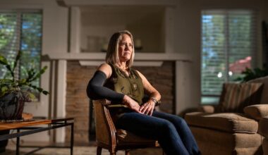 What is lymphedema and how to people get it? – Deseret News