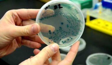 Flesh eating bacteria kills 1 person in South Florida in 2025