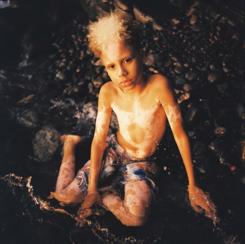 A young person with light and dark patches of skin and curly hair sits in shallow water, looking up at the camera. They wear patterned swim trunks, and the background is rocky and dimly lit.