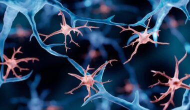 Fatal genetic disorder treated by replacing the brain's immune cells