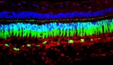 UC Davis Lands $3.6M NIH Grant for Eye Gene Therapy