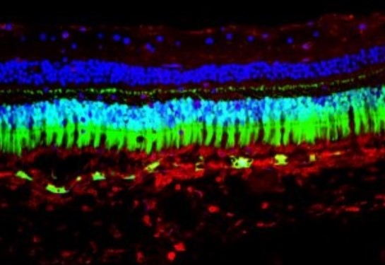 UC Davis Lands $3.6M NIH Grant for Eye Gene Therapy