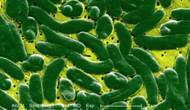 4 people have died from flesh-eating bacteria in Florida: Who is at risk?