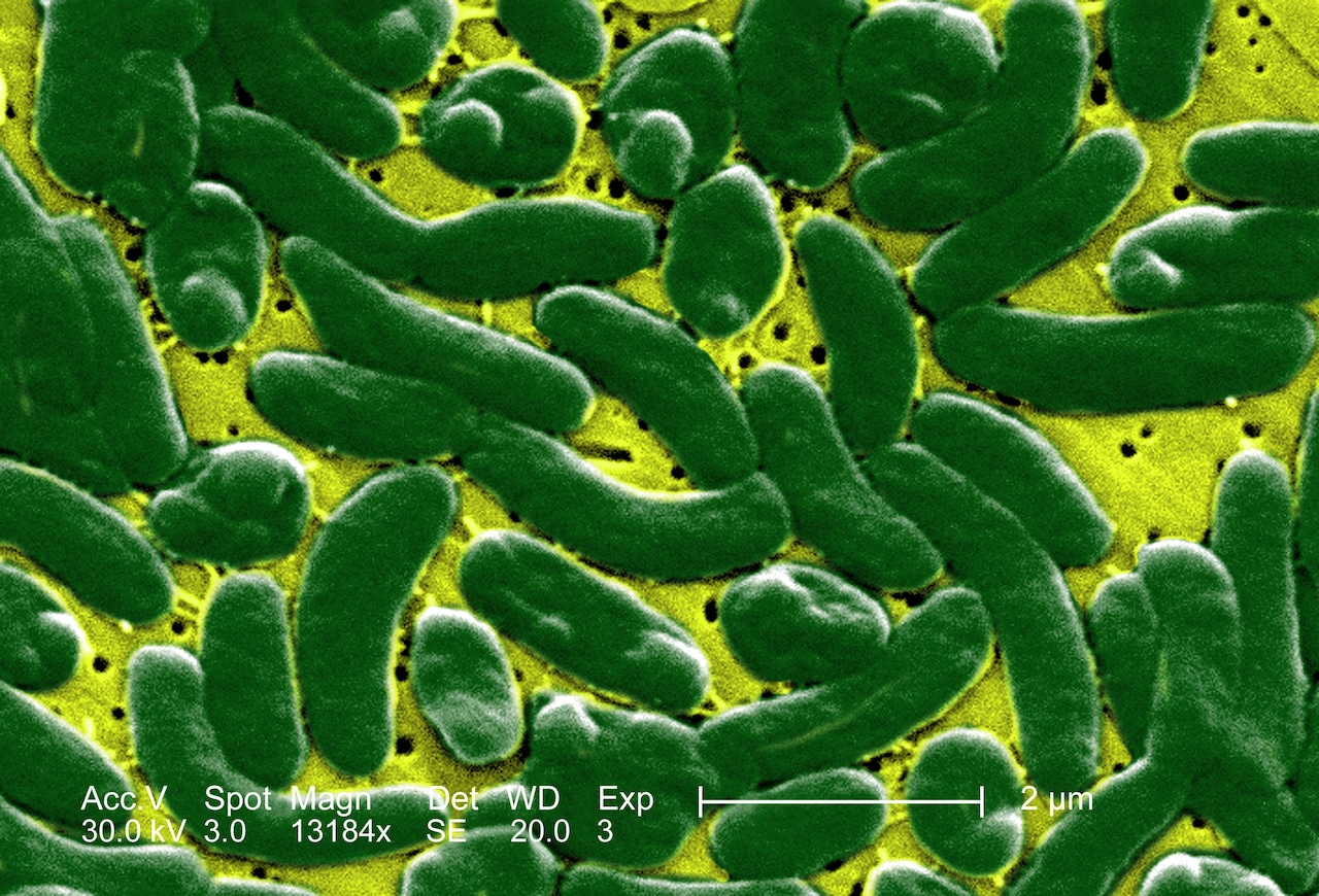 4 people have died from flesh-eating bacteria in Florida: Who is at risk?