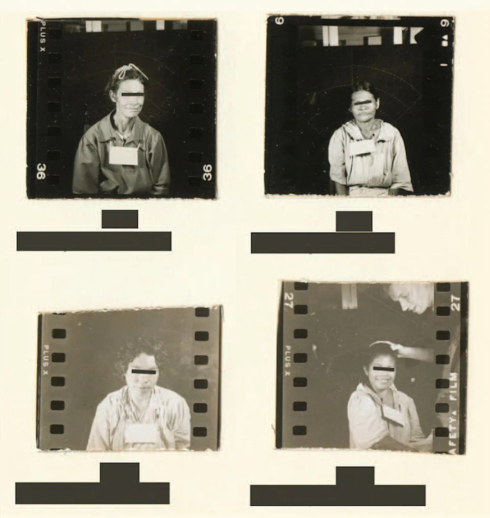 Four vintage black-and-white photos of a seated individual with eyes covered, each slightly different in pose