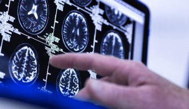 Novel brain scan may predict age-related disease
