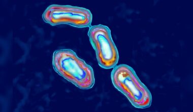 1 person dies of the Plague in northern Arizona