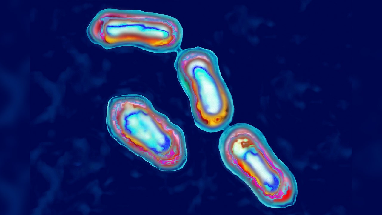 1 person dies of the Plague in northern Arizona