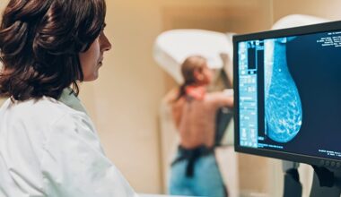 AI Outperforms Humans in Mammography Analysis