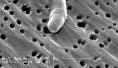 Flesh-eating bacteria kills 4; what is Vibrio vulnificus – WHIO TV 7 and WHIO Radio