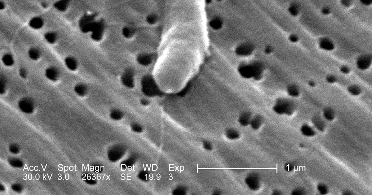 Flesh-eating bacteria kills 4; what is Vibrio vulnificus – WHIO TV 7 and WHIO Radio