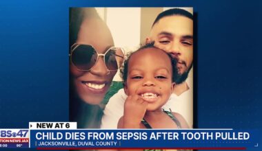 Jacksonville parents grieving 7-year-old daughter after she died following a visit to the dentist