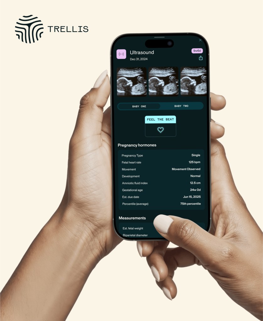 Smartphone displaying ultrasound images and fetal information from Trellis Health app.