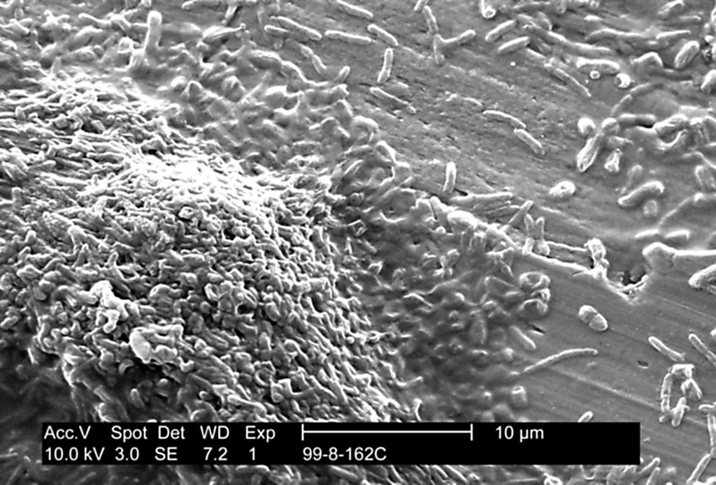 Scanning electron micrograph of Legionella pneumophila bacteria in potable water biofilm.
